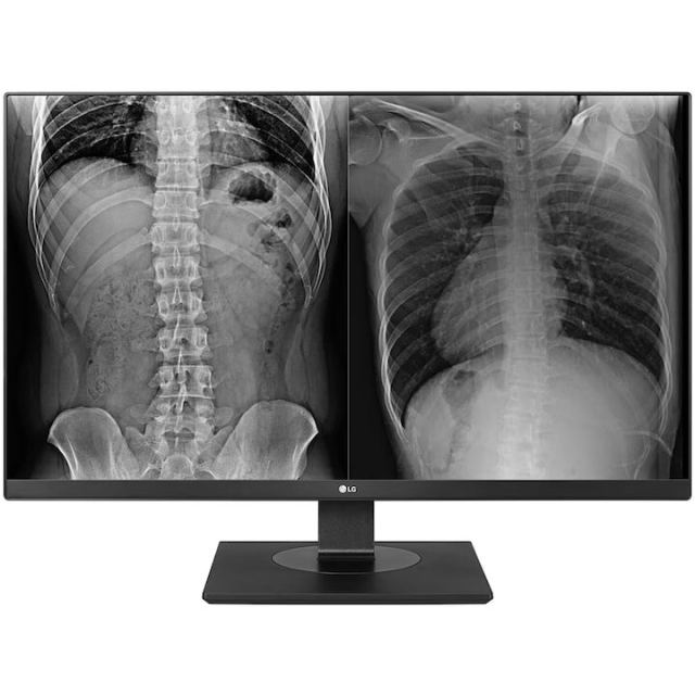 LG Monitor Medical LED IPS LG 27HJ713C-B.AEE, Diagonala 27, 8MP, 4K UHD (3840x2160)